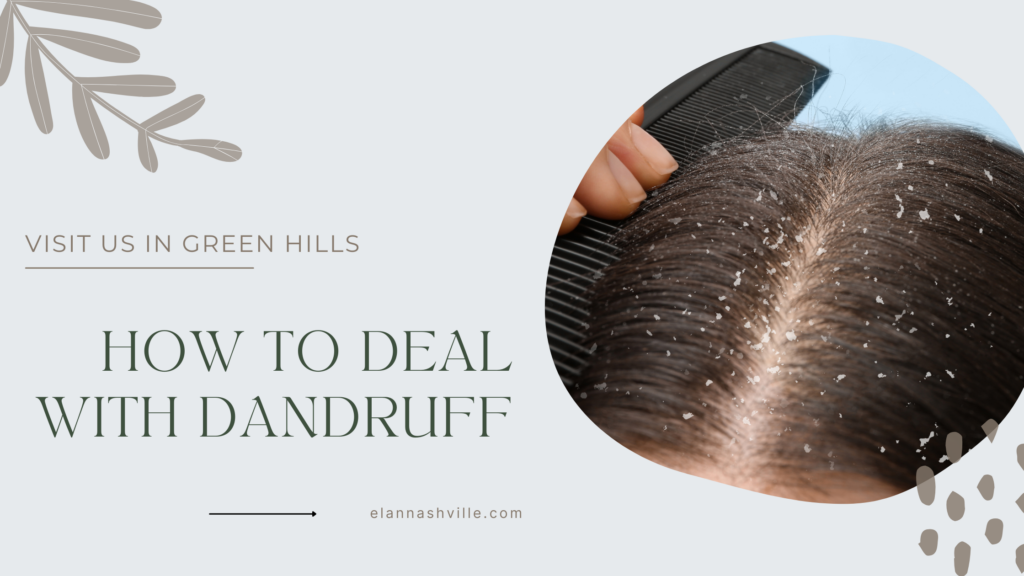 How to Deal with Dandruff